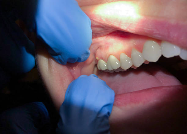 Professional Emergency Dentist in AR